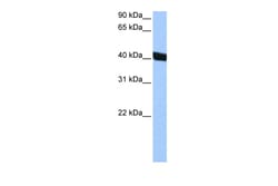 Aviva Systems Biology Corp CHI3L1 Antibody - middle region (ARP51929_P050)