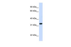 Aviva Systems Biology Corp TBCB Antibody - C-terminal region (ARP51934_P050)