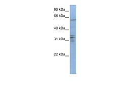 Aviva Systems Biology Corp CENPB Antibody - C-terminal region (ARP51969_P050)