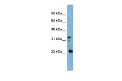 Aviva Systems Biology Corp CRYBB3 Antibody - middle region (ARP52026_P050)