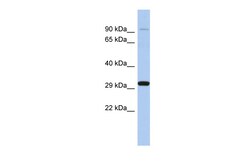 Aviva Systems Biology Corp ENDOG Antibody - middle region (ARP52054_P050)