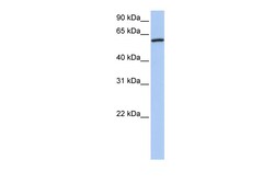 Aviva Systems Biology Corp CTTN Antibody - N-terminal region (ARP52067_P050)