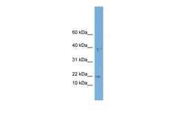 Aviva Systems Biology Corp ARPC3 Antibody - middle region (ARP52093_P050)