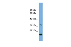 Aviva Systems Biology Corp CTDSP2 Antibody - middle region (ARP52097_P050)