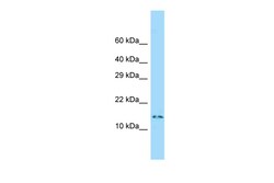 Aviva Systems Biology Corp Dnalc4 Antibody - middle region (ARP52101_P050)