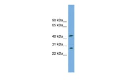 Aviva Systems Biology Corp RABEPK Antibody - N-terminal region (ARP52114_P050)