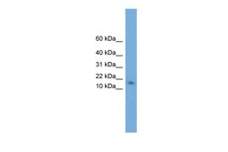 Aviva Systems Biology Corp RIDA Antibody - N-terminal region (ARP52116_P050)