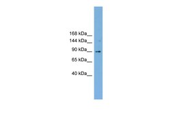Aviva Systems Biology Corp TACC3 Antibody - middle region (ARP52149_P050)