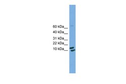 Aviva Systems Biology Corp PPIH Antibody - middle region (ARP52154_P050)
