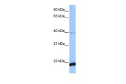 Aviva Systems Biology Corp HBS1L Antibody - C-terminal region (ARP52212_P050)