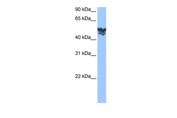 Aviva Systems Biology Corp WASF3 Antibody - middle region (ARP52220_P050)