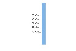 Aviva Systems Biology Corp CPLX2 Antibody - N-terminal region (ARP52225_P050)