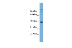 Aviva Systems Biology Corp SUGT1 Antibody - middle region (ARP52240_P050)