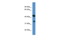 Aviva Systems Biology Corp Centa1 Antibody - C-terminal region (ARP52270_P050)