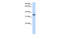 Aviva Systems Biology Corp SPON2 Antibody - middle region (ARP52336_P050)