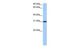 Aviva Systems Biology Corp PRDX3 Antibody - N-terminal region (ARP52341_P050)