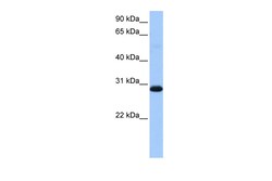 Aviva Systems Biology Corp WARS2 Antibody - middle region (ARP52366_P050)