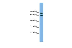Aviva Systems Biology Corp DAB1 Antibody - middle region (ARP52396_P050)
