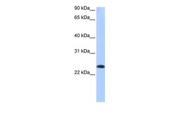 Aviva Systems Biology Corp EGLN3 Antibody - C-terminal region (ARP52402_P050)