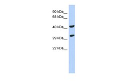 Aviva Systems Biology Corp ASB8 Antibody - N-terminal region (ARP52408_P050)