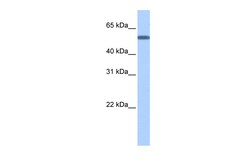 Aviva Systems Biology Corp TOE1 Antibody - N-terminal region (ARP52410_P050)