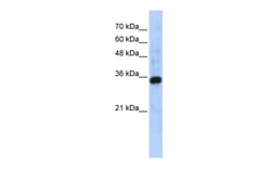 Aviva Systems Biology Corp C1QTNF4 Antibody - middle region (ARP52425_P050)