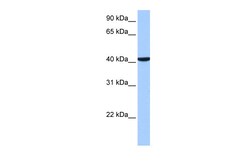 Aviva Systems Biology Corp CC2D1B Antibody - C-terminal region (ARP52428_P050)