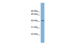 Aviva Systems Biology Corp LRG1 Antibody - N-terminal region (ARP52475_P050)