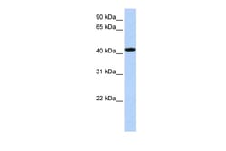 Aviva Systems Biology Corp TADA1L Antibody - C-terminal region (ARP52480_P050)