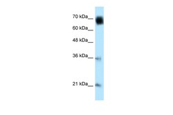 Aviva Systems Biology Corp GLMN Antibody - C-terminal region (ARP52485_P050)