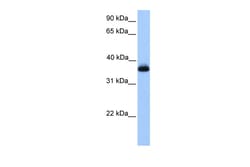 Aviva Systems Biology Corp ERI2 Antibody - middle region (ARP52509_P050)