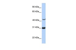 Aviva Systems Biology Corp NUP35 Antibody - C-terminal region (ARP52579_P050)