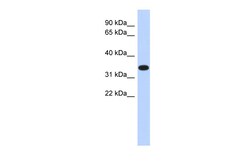 Aviva Systems Biology Corp ACTRT1 Antibody - middle region (ARP52580_P050)