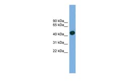 Aviva Systems Biology Corp ACTRT1 Antibody - middle region (ARP52581_P050)