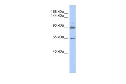 Aviva Systems Biology Corp GPRASP2 Antibody - middle region (ARP52604_P050)