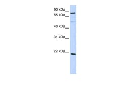Aviva Systems Biology Corp ARL11 Antibody - middle region (ARP52609_P050)
