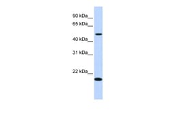Aviva Systems Biology Corp EXOC3-AS1 Antibody - N-terminal region (ARP52617_P050)