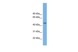 Aviva Systems Biology Corp MIPOL1 Antibody - middle region (ARP52631_P050)