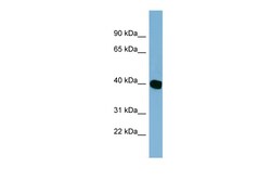 Aviva Systems Biology Corp C14orf148 Antibody - middle region (ARP52636_P050)