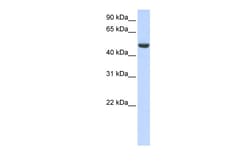 Aviva Systems Biology Corp SPATA17 Antibody - C-terminal region (ARP52643_P050)