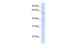 Aviva Systems Biology Corp C16orf71 Antibody - middle region (ARP52676_P050)