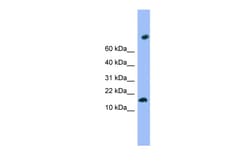 Aviva Systems Biology Corp TMEM42 Antibody - N-terminal region (ARP52709_P050)