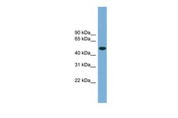 Aviva Systems Biology Corp UBQLNL Antibody - middle region (ARP52793_P050)