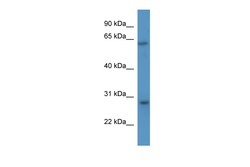 Aviva Systems Biology Corp Cish Antibody - N-terminal region (ARP52798_P050)