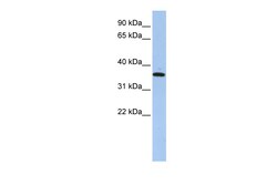 Aviva Systems Biology Corp FAM84A Antibody - N-terminal region (ARP52806_P050)