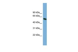 Aviva Systems Biology Corp OMA1 Antibody - middle region (ARP52818_P050)