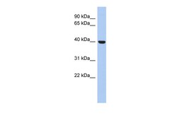 Aviva Systems Biology Corp STOML3 Antibody - N-terminal region (ARP52851_P050)