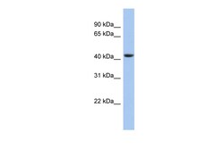 Aviva Systems Biology Corp STOML3 Antibody - middle region (ARP52852_P050)