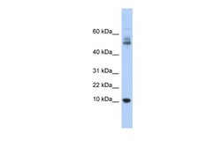 Aviva Systems Biology Corp MTPN Antibody - middle region (ARP52859_P050)