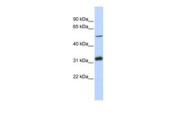 Aviva Systems Biology Corp TC2N Antibody - middle region (ARP52895_P050)